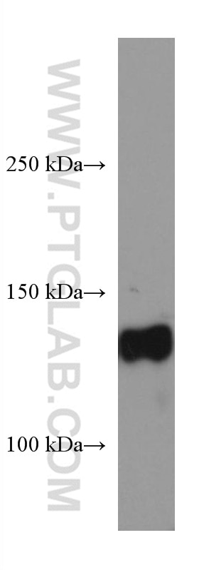 Western Blot (WB) analysis of mouse kidney tissue using KL Monoclonal antibody (67331-1-Ig)