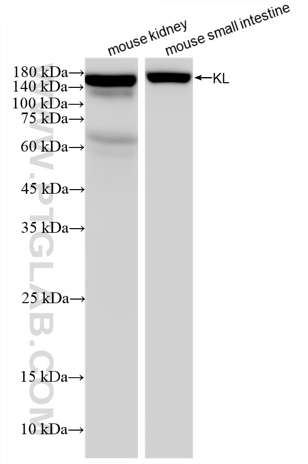 Western Blot (WB) analysis of various lysates using KL Recombinant monoclonal antibody (87584-1-RR)