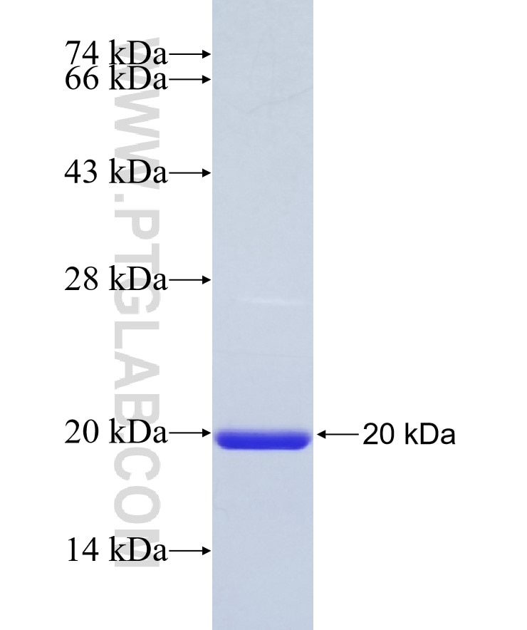 KL fusion protein Ag27838 SDS-PAGE