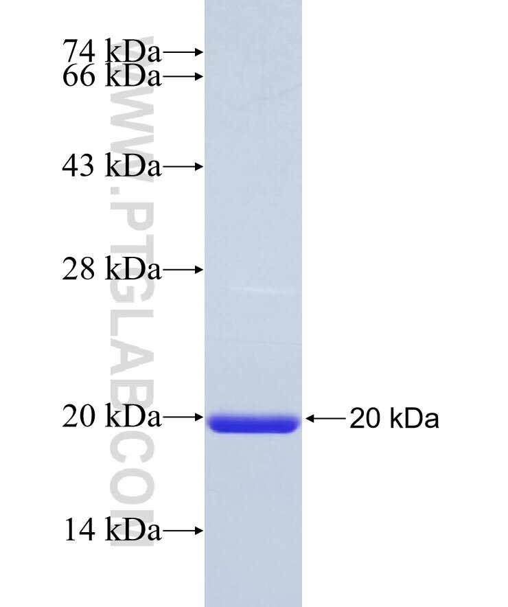 KL fusion protein Ag27838 SDS-PAGE