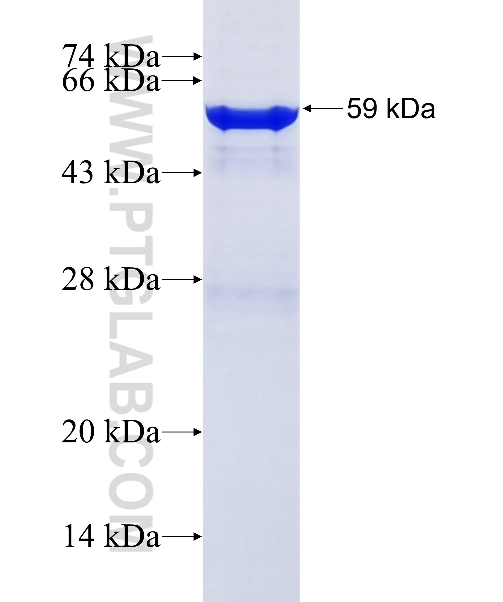 KLB fusion protein Ag36993 SDS-PAGE KLB fusion protein Ag36993 SDS-PAGE