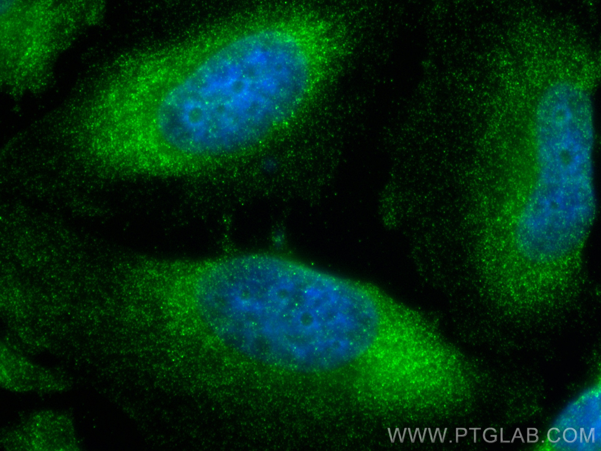 Immunofluorescence (IF) / fluorescent staining of HeLa cells using KLC1 Polyclonal antibody (19028-1-AP)