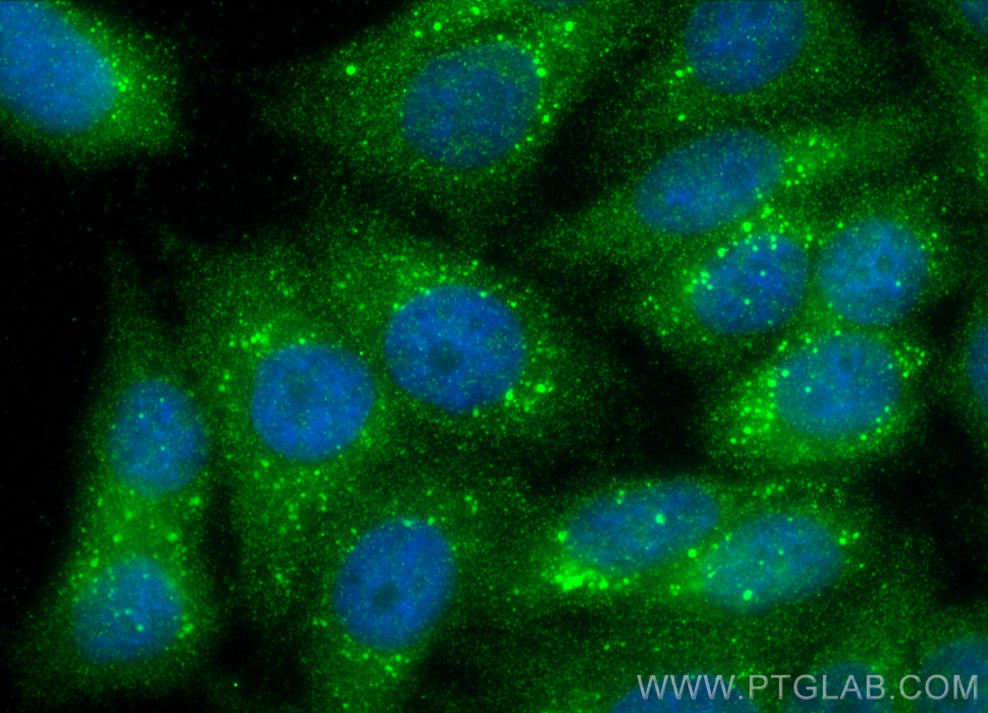Immunofluorescence (IF) / fluorescent staining of HepG2 cells using KLC1 Polyclonal antibody (19028-1-AP)