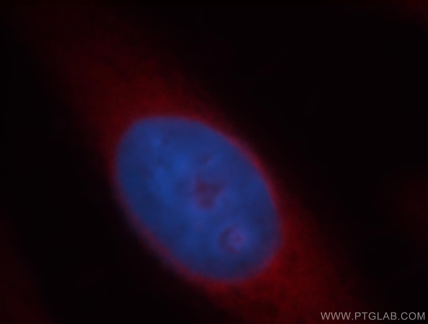 Immunofluorescence (IF) / fluorescent staining of HeLa cells using KLC1 Polyclonal antibody (19028-1-AP)