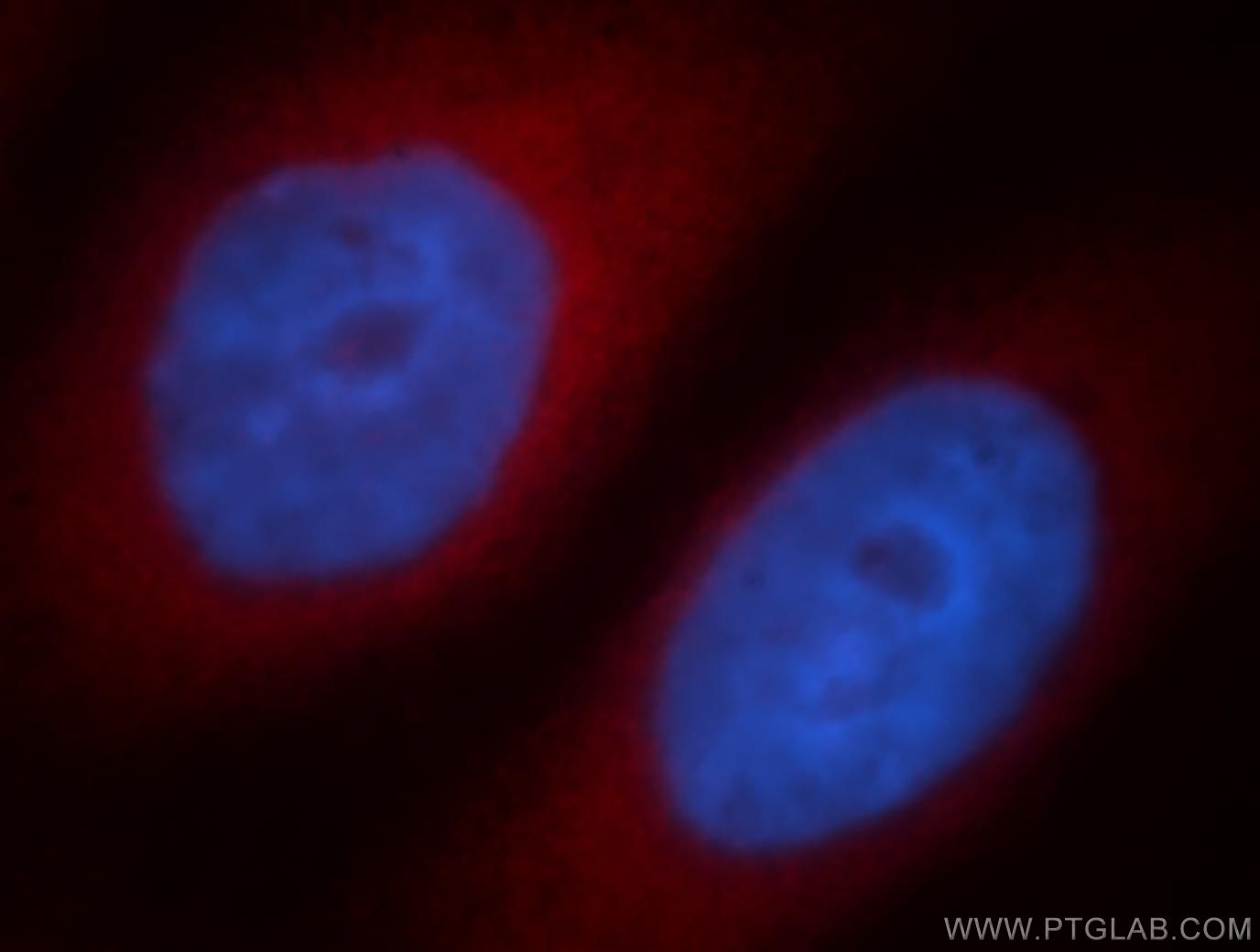 Immunofluorescence (IF) / fluorescent staining of HepG2 cells using KLC1 Polyclonal antibody (19028-1-AP)
