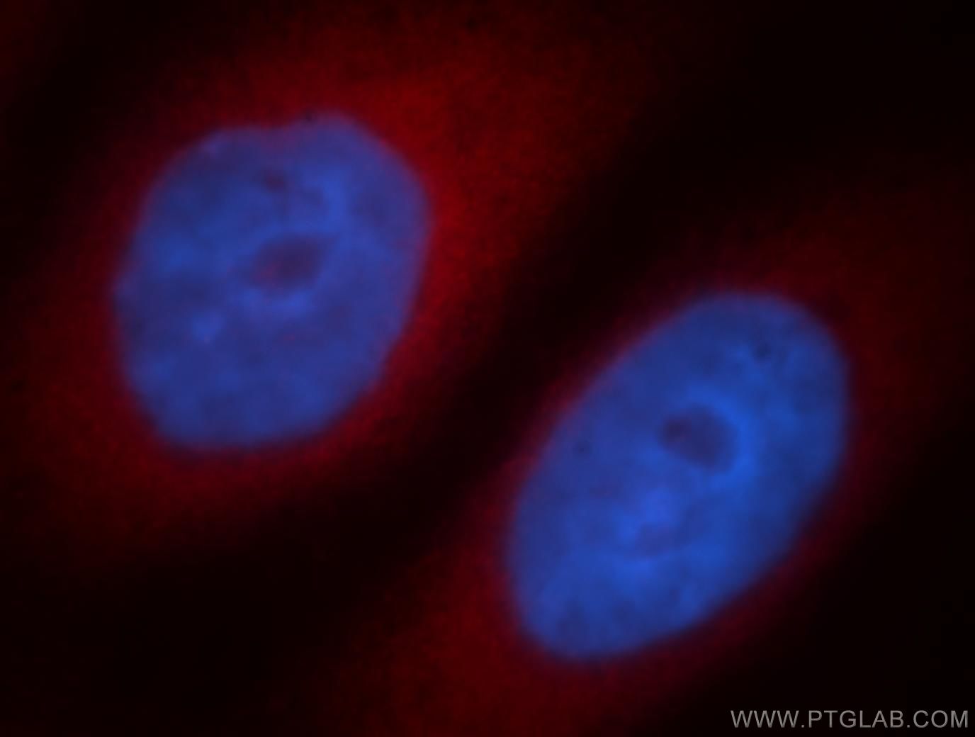 IF Staining of HepG2 using 19028-1-AP