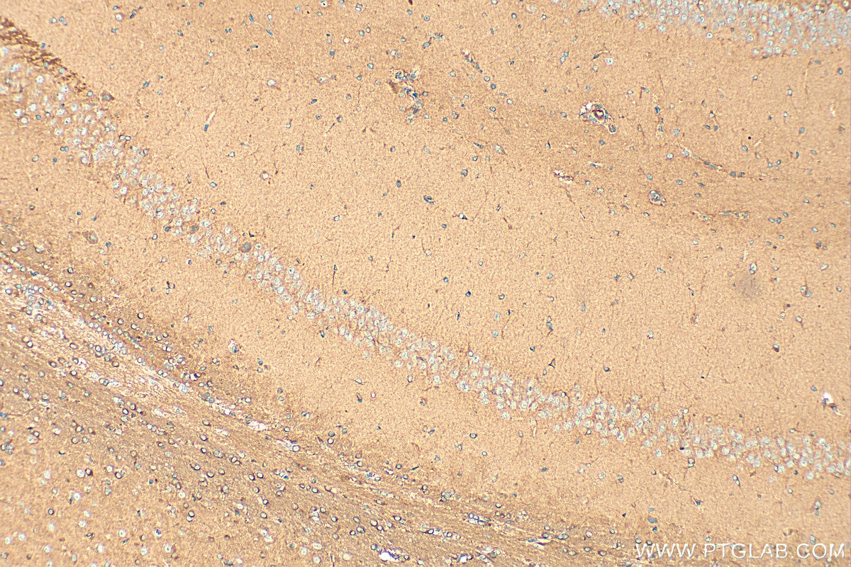 Immunohistochemistry (IHC) staining of rat brain tissue using KLC1 Polyclonal antibody (19028-1-AP)