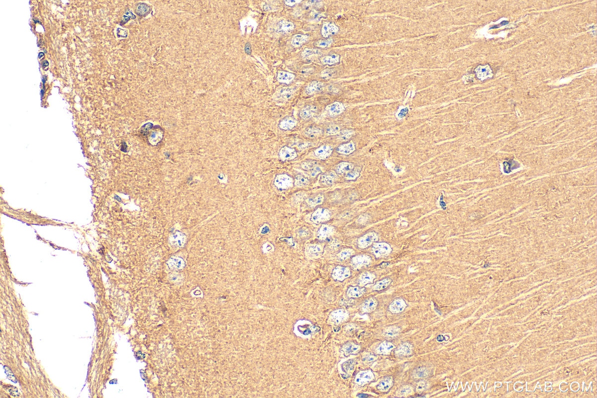 Immunohistochemistry (IHC) staining of mouse brain tissue using KLC1 Polyclonal antibody (19028-1-AP)