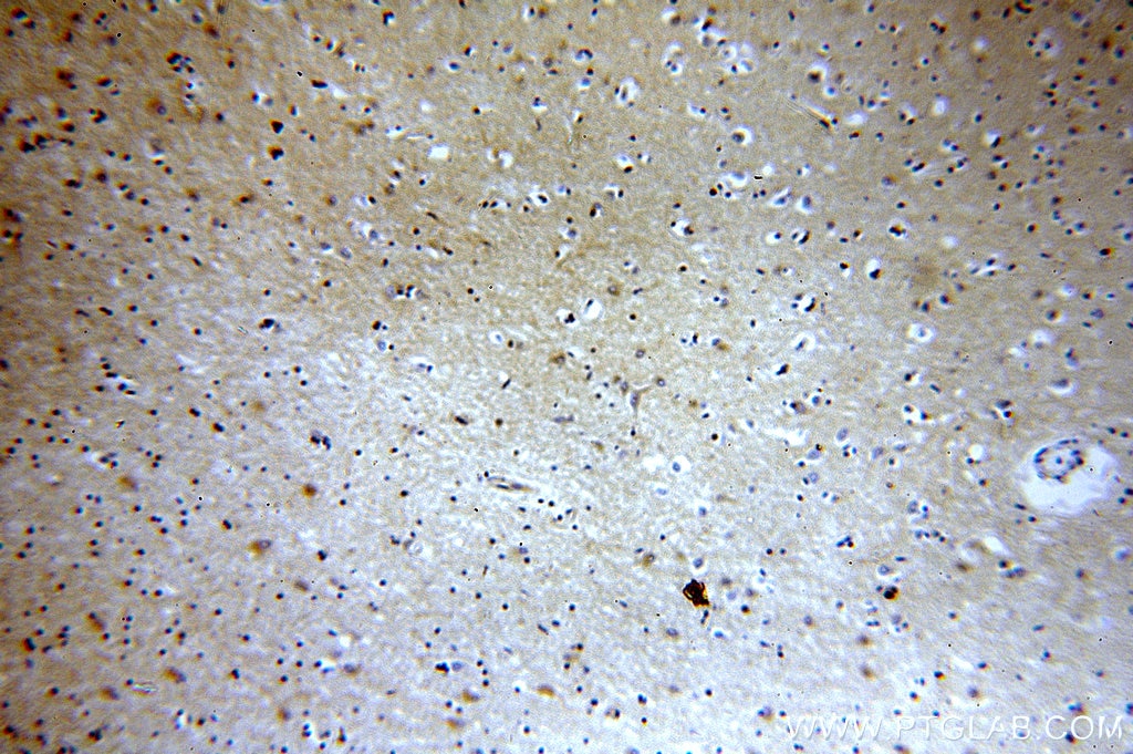 Immunohistochemistry (IHC) staining of human brain tissue using KLC1 Polyclonal antibody (19028-1-AP)