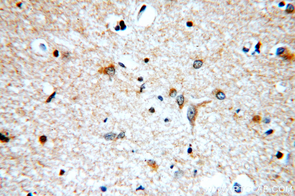 Immunohistochemistry (IHC) staining of human brain tissue using KLC1 Polyclonal antibody (19028-1-AP)