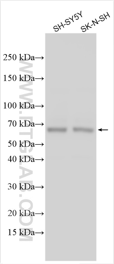 Western Blot (WB) analysis of various lysates using KLC1 Polyclonal antibody (19028-1-AP)