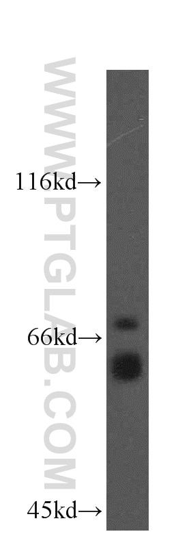 Western Blot (WB) analysis of mouse brain tissue using KLC1 Polyclonal antibody (19028-1-AP)