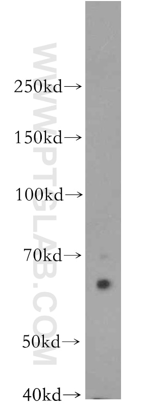 Western Blot (WB) analysis of COLO 320 cells using KLC1 Polyclonal antibody (19028-1-AP)