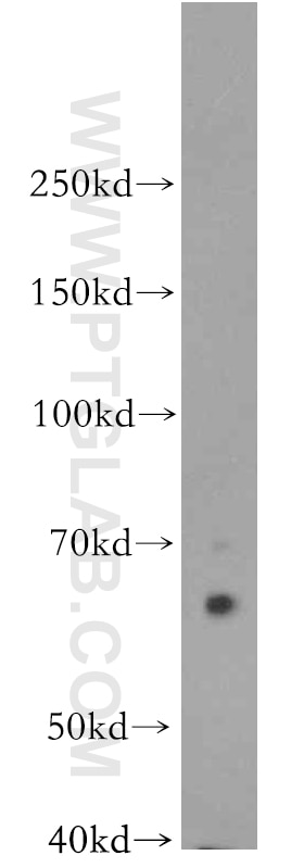 WB analysis of COLO 320 using 19028-1-AP