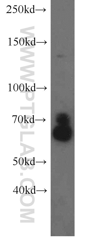 Western Blot (WB) analysis of SH-SY5Y cells using KLC1 Polyclonal antibody (19028-1-AP)
