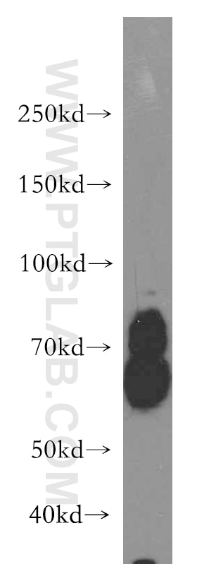 Western Blot (WB) analysis of HepG2 cells using KLC1 Polyclonal antibody (19028-1-AP)