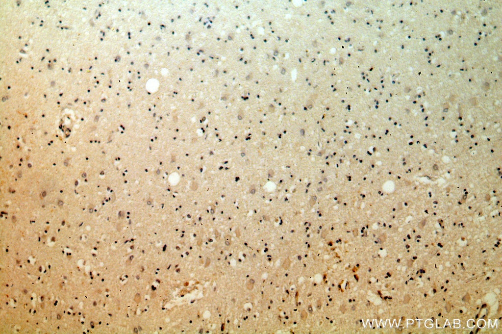 Immunohistochemistry (IHC) staining of human brain tissue using KLC2 Polyclonal antibody (17668-1-AP)