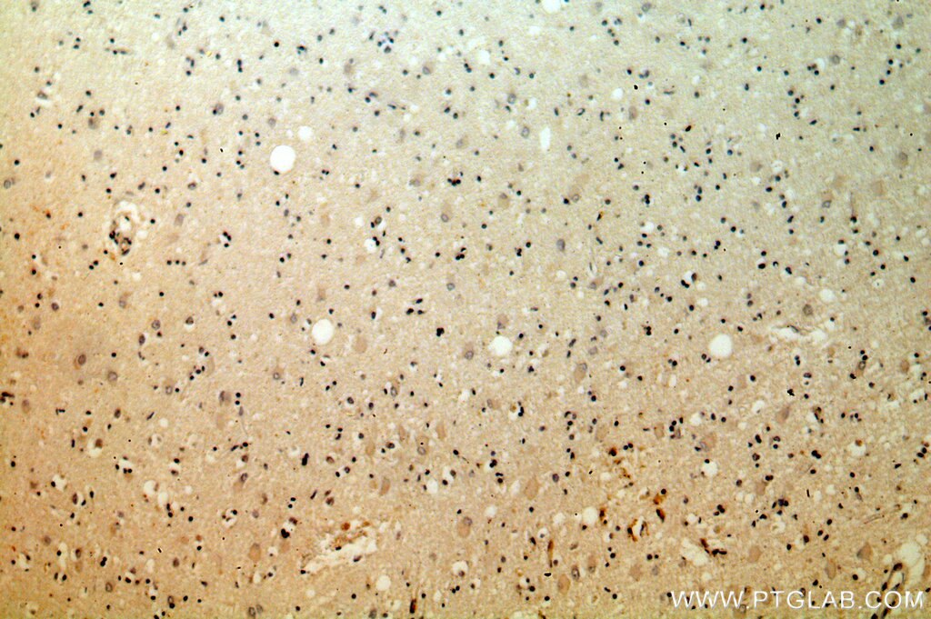 Immunohistochemistry (IHC) staining of human brain tissue using KLC2 Polyclonal antibody (17668-1-AP)