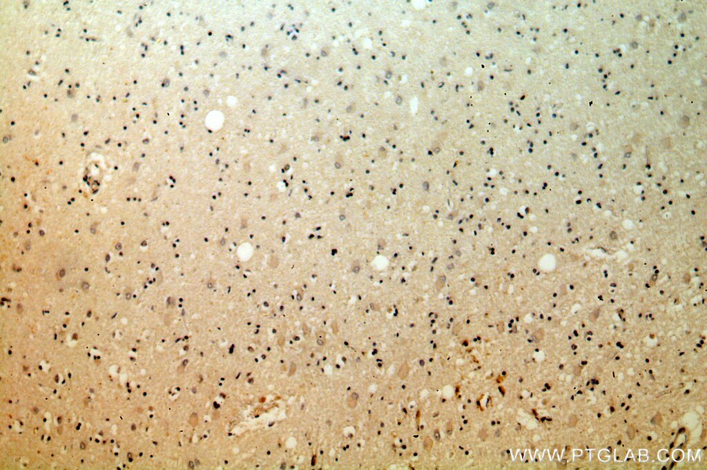 Immunohistochemistry (IHC) staining of human brain tissue using KLC2 Polyclonal antibody (17668-1-AP)