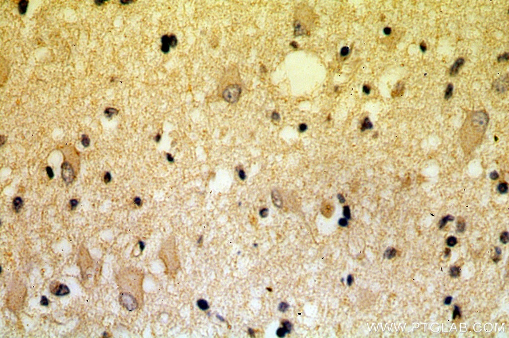 Immunohistochemistry (IHC) staining of human brain tissue using KLC2 Polyclonal antibody (17668-1-AP)