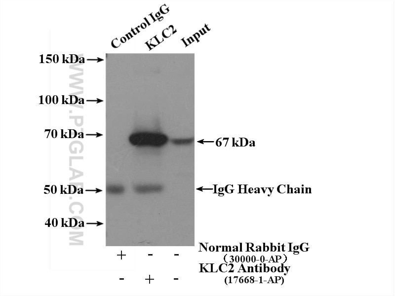 Immunoprecipitation (IP) experiment of mouse testis tissue using KLC2 Polyclonal antibody (17668-1-AP)