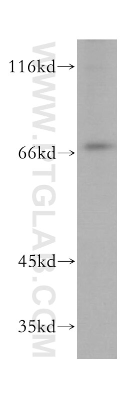 Western Blot (WB) analysis of mouse lung tissue using KLC2 Polyclonal antibody (17668-1-AP)