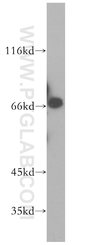 Western Blot (WB) analysis of mouse testis tissue using KLC2 Polyclonal antibody (17668-1-AP)