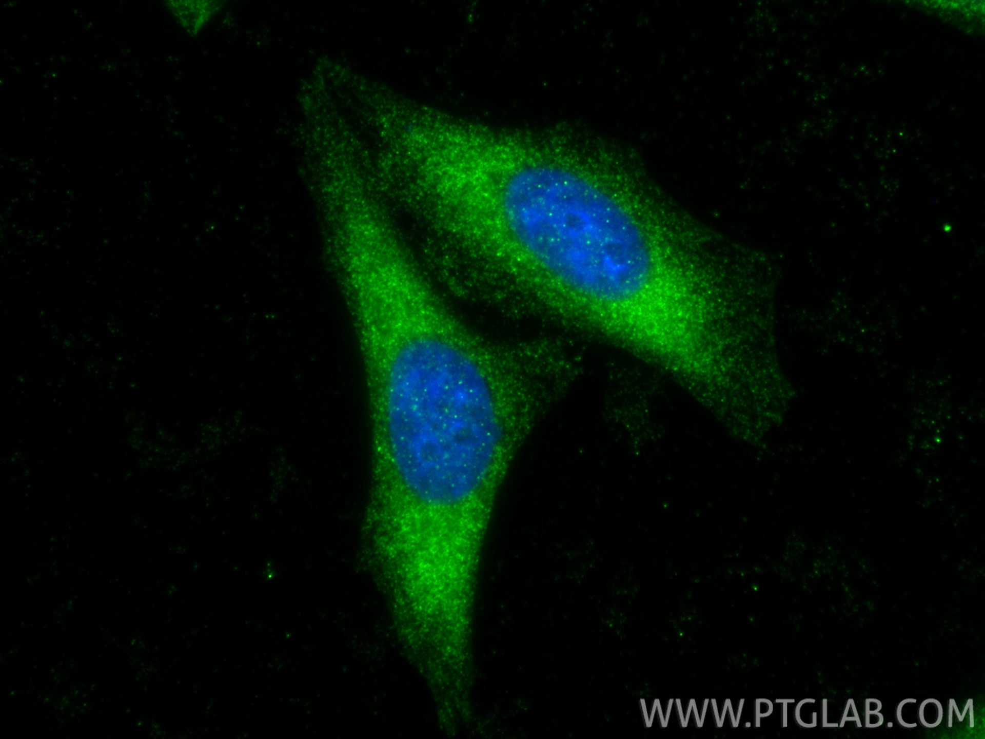 IF Staining of HepG2 using 11645-1-AP Immunofluorescence (IF) / fluorescent staining of HepG2 cells using KLC3 Polyclonal antibody (11645-1-AP)