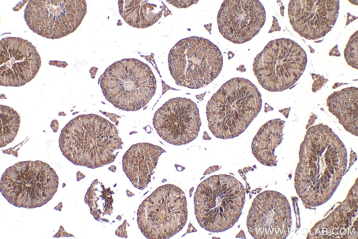 IHC staining of mouse testis using 11645-1-AP Immunohistochemistry (IHC) staining of mouse testis tissue using KLC3 Polyclonal antibody (11645-1-AP)