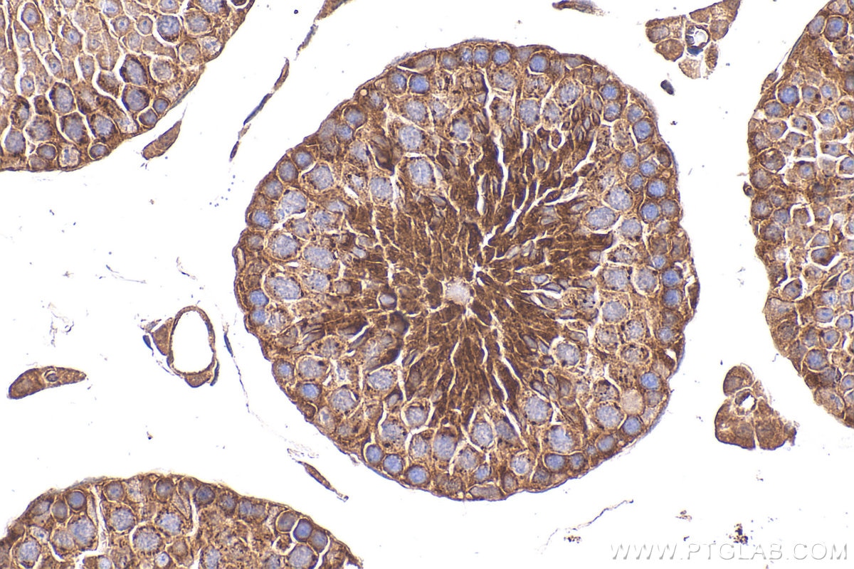 IHC staining of mouse testis using 11645-1-AP Immunohistochemistry (IHC) staining of mouse testis tissue using KLC3 Polyclonal antibody (11645-1-AP)