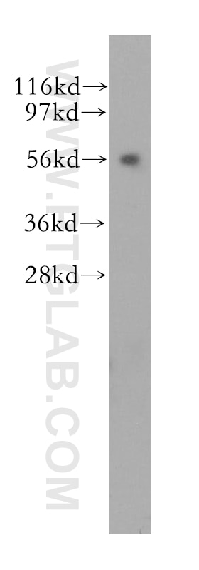 Western Blot (WB) analysis of human liver tissue using KLC3 Polyclonal antibody (11645-1-AP)