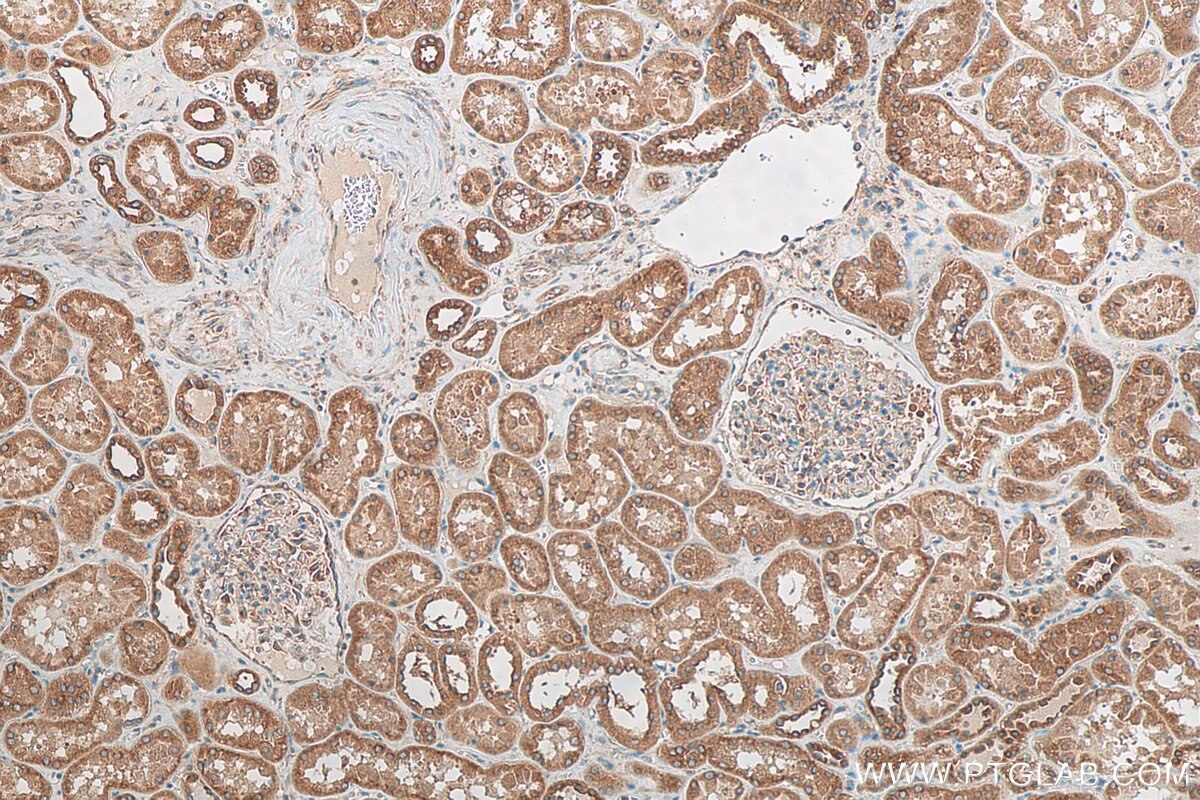 Immunohistochemistry (IHC) staining of human kidney tissue using KLC4 Polyclonal antibody (16493-1-AP)