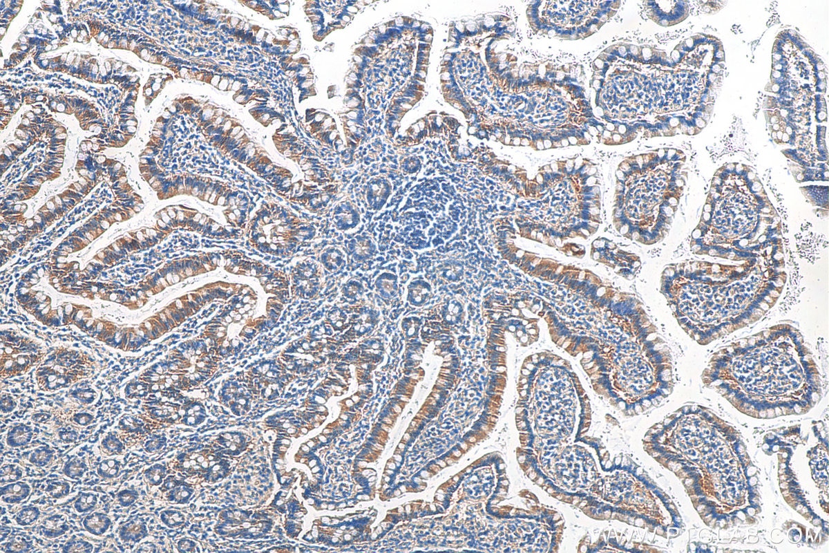 Immunohistochemistry (IHC) staining of human small intestine tissue using KLC4 Polyclonal antibody (16493-1-AP)
