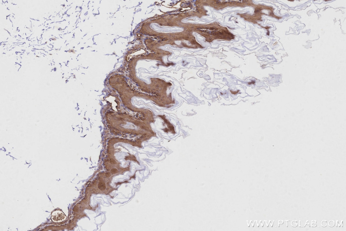 IHC staining of mouse stomach using 16493-1-AP Immunohistochemistry (IHC) staining of mouse stomach tissue using KLC4 Polyclonal antibody (16493-1-AP)