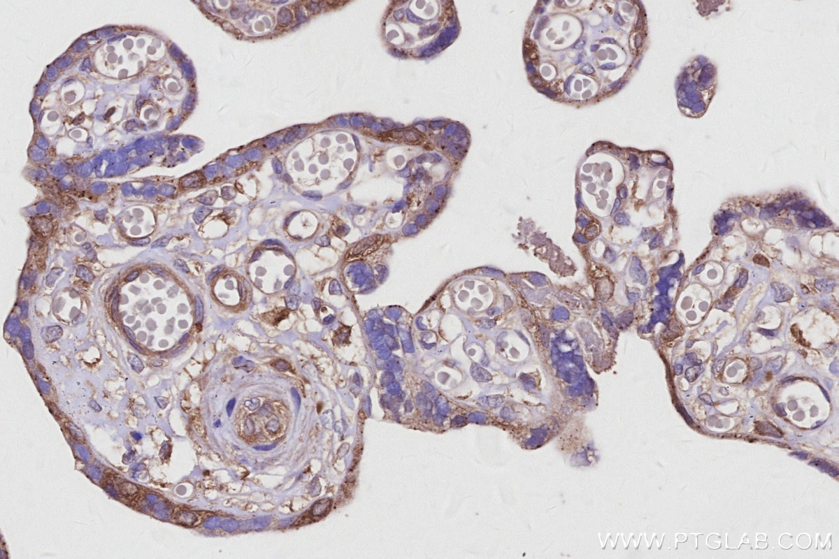 IHC staining of human placenta using 16493-1-AP Immunohistochemistry (IHC) staining of human placenta tissue using KLC4 Polyclonal antibody (16493-1-AP)