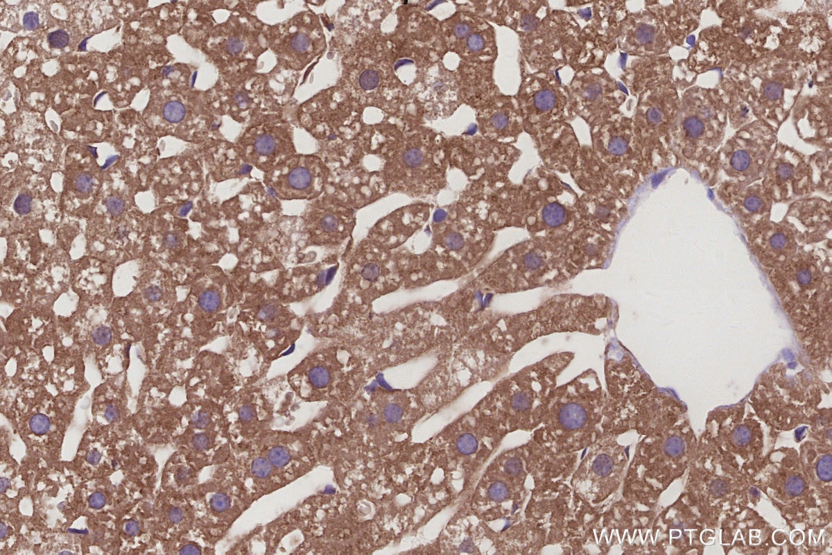 IHC staining of mouse liver using 16493-1-AP Immunohistochemistry (IHC) staining of mouse liver tissue using KLC4 Polyclonal antibody (16493-1-AP)