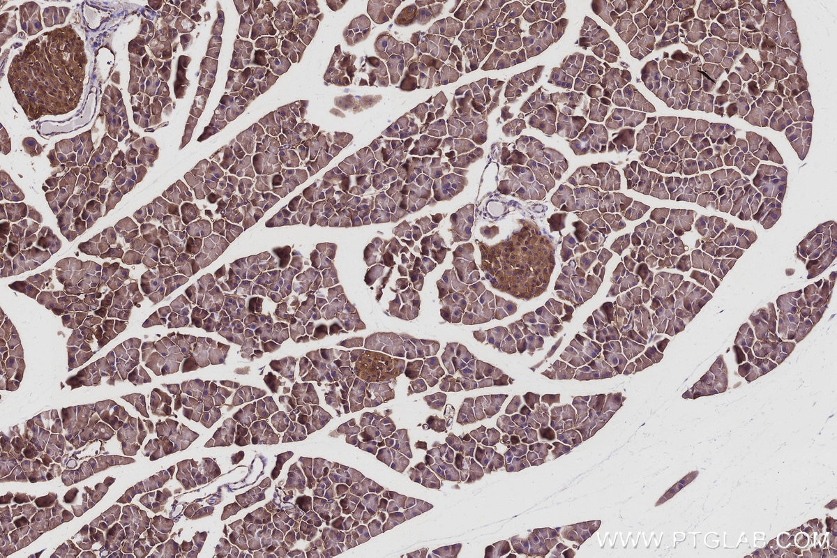 IHC staining of mouse pancreas using 16493-1-AP Immunohistochemistry (IHC) staining of mouse pancreas tissue using KLC4 Polyclonal antibody (16493-1-AP)