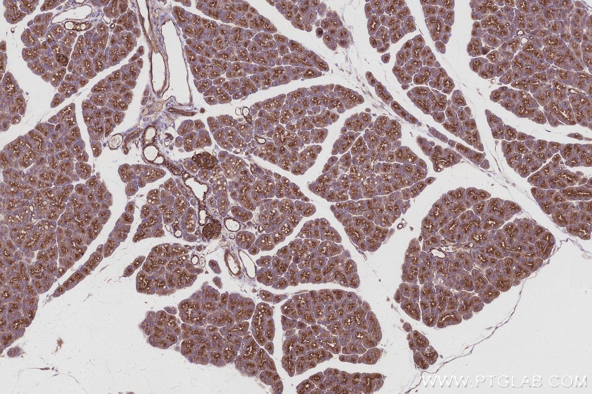 IHC staining of rat pancreas using 16493-1-AP Immunohistochemistry (IHC) staining of rat pancreas tissue using KLC4 Polyclonal antibody (16493-1-AP)