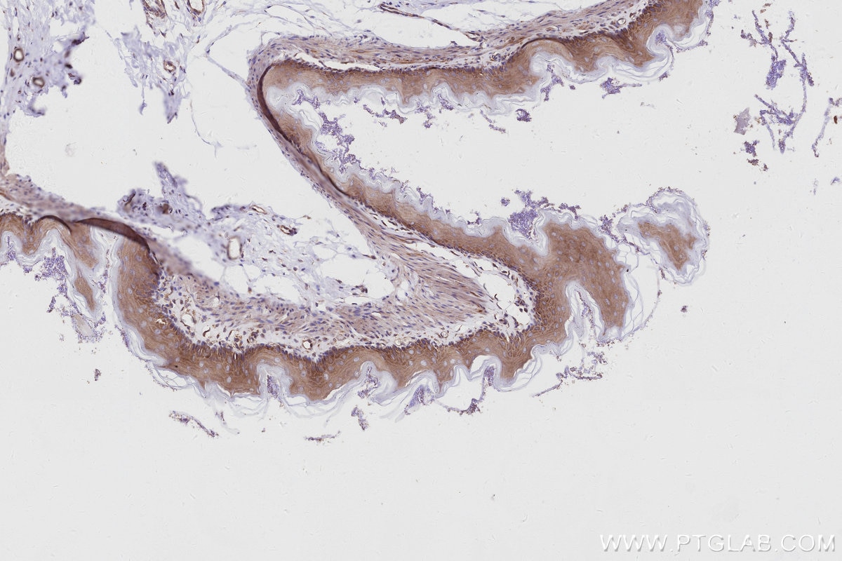 IHC staining of rat stomach using 16493-1-AP Immunohistochemistry (IHC) staining of rat stomach tissue using KLC4 Polyclonal antibody (16493-1-AP)