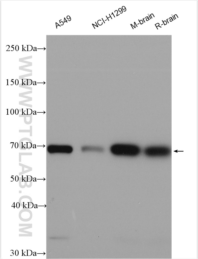Western Blot (WB) analysis of various lysates using KLC4 Polyclonal antibody (16493-1-AP)