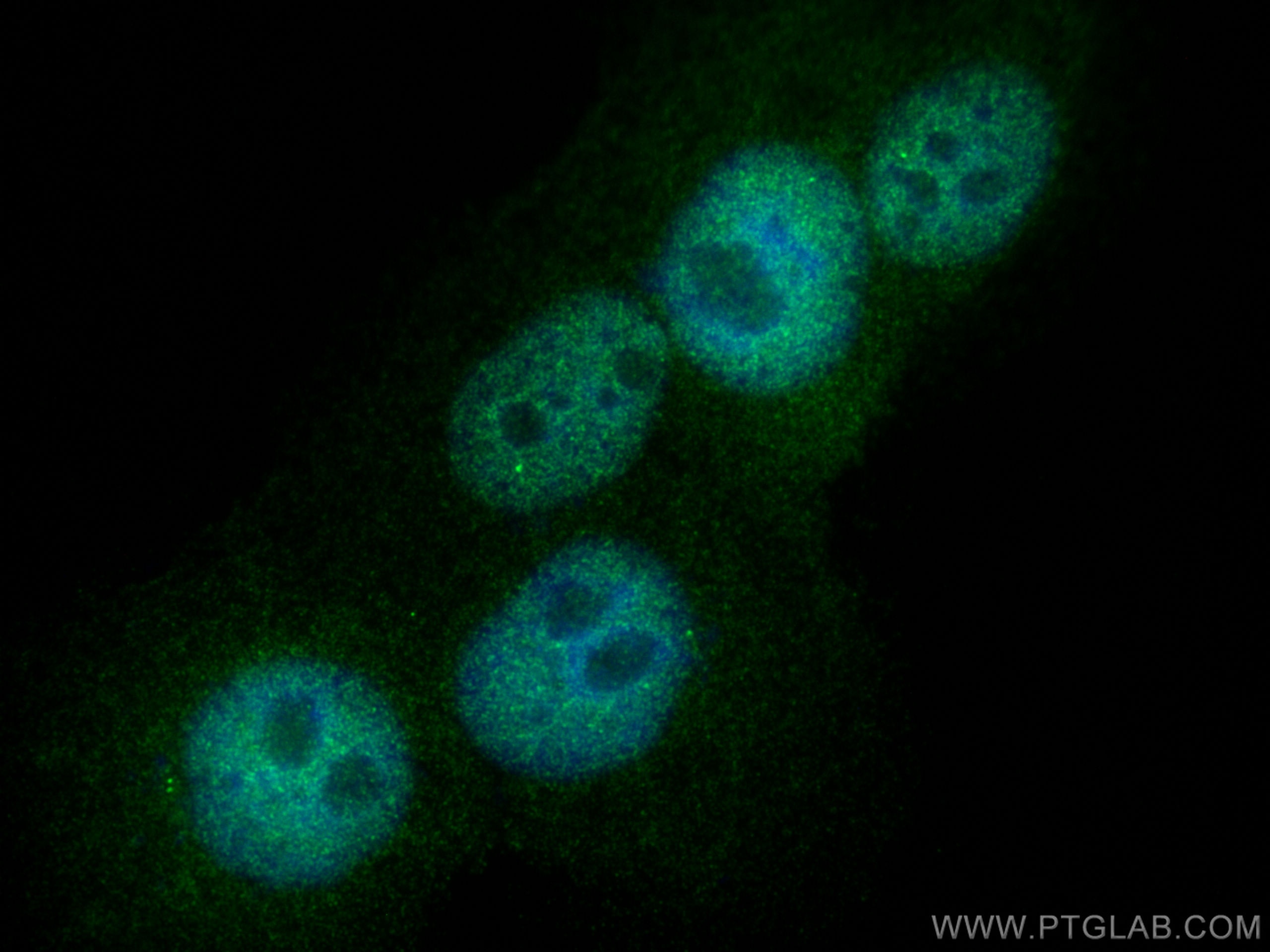 Immunofluorescence (IF) / fluorescent staining of A431 cells using KLF1 Polyclonal antibody (18887-1-AP)