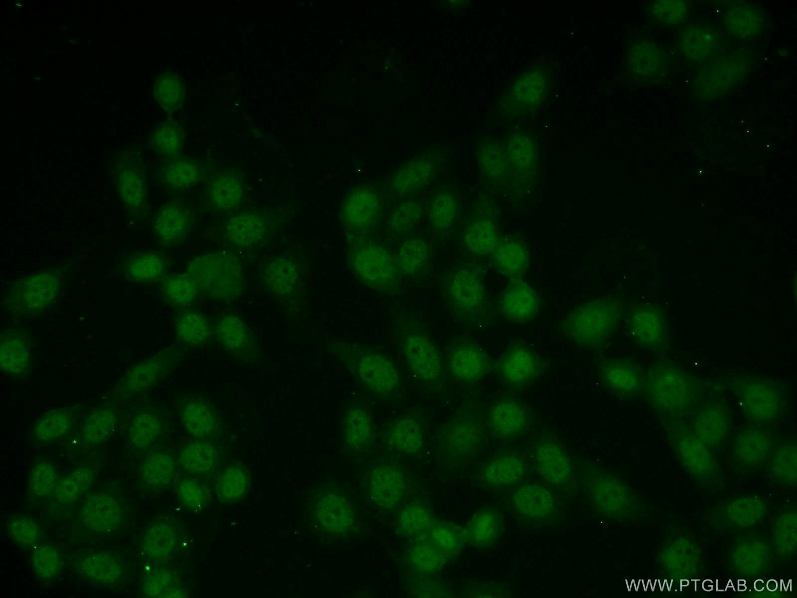 Immunofluorescence (IF) / fluorescent staining of HeLa cells using KLF10 Polyclonal antibody (11881-1-AP)