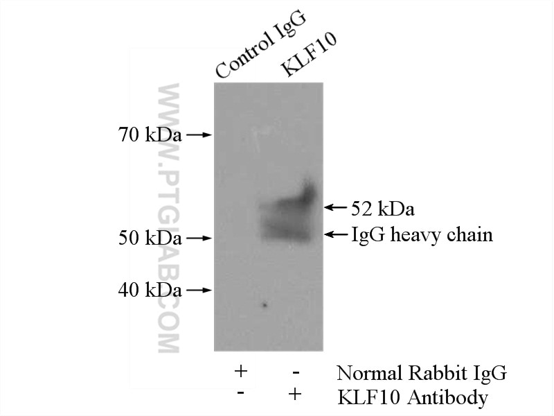 Immunoprecipitation (IP) experiment of Jurkat cells using KLF10 Polyclonal antibody (11881-1-AP)
