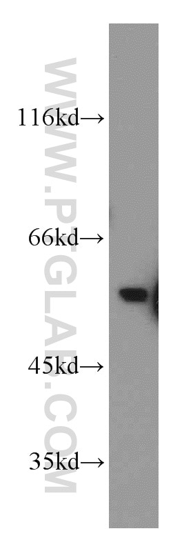 Western Blot (WB) analysis of HeLa cells using KLF10 Polyclonal antibody (11881-1-AP)