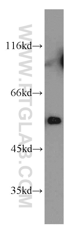 Western Blot (WB) analysis of Jurkat cells using KLF10 Polyclonal antibody (11881-1-AP)