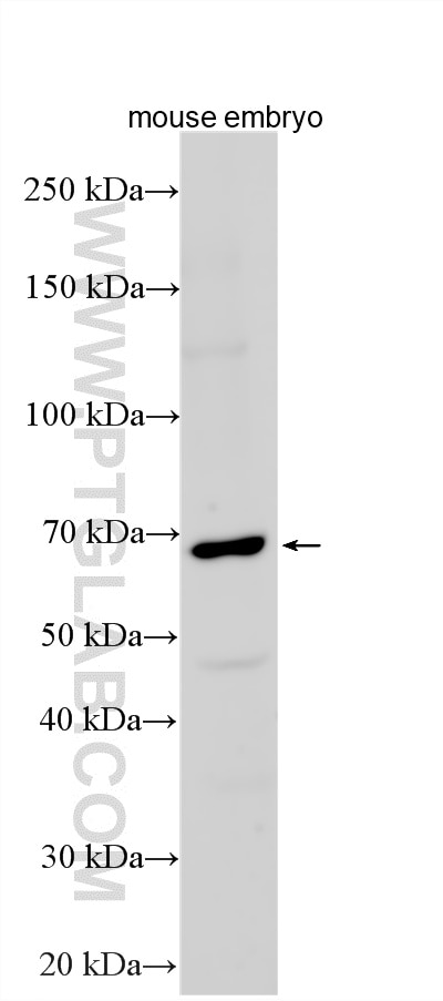 WB analysis using 34052-1-AP Western Blot (WB) analysis of various lysates using KLF11 Polyclonal antibody (34052-1-AP)