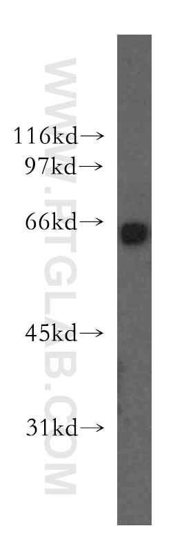 Western Blot (WB) analysis of human kidney tissue using KLF12 Polyclonal antibody (13156-1-AP)