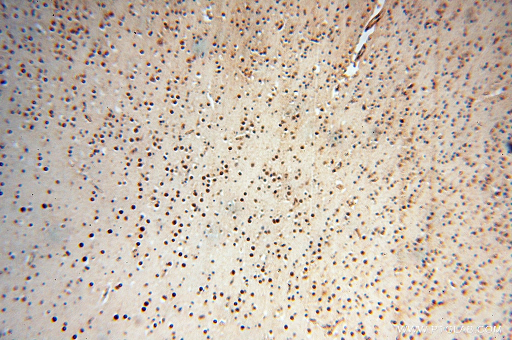 Immunohistochemistry (IHC) staining of human brain tissue using KLF13 Polyclonal antibody (18352-1-AP)