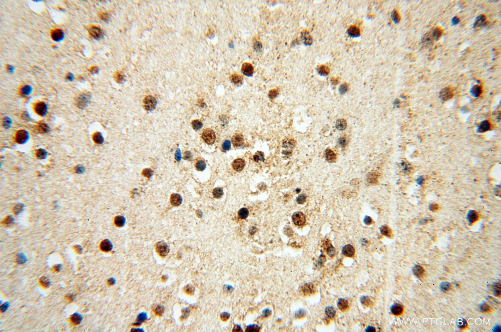 Immunohistochemistry (IHC) staining of human brain tissue using KLF13 Polyclonal antibody (18352-1-AP)