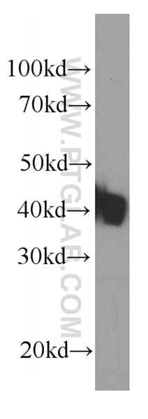 Western Blot (WB) analysis of human skeletal muscle tissue using KLF15 Monoclonal antibody (66185-1-Ig)